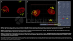 H2AX SRM Antibody in Immunocytochemistry (ICC/IF)