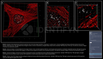 gamma-H2AX SRM Antibody in Immunocytochemistry (ICC/IF)