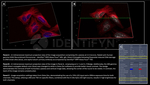 gamma-H2AX SRM Antibody in Immunocytochemistry (ICC/IF)