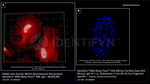 BRCA1 Antibody in Immunocytochemistry (ICC/IF)