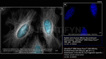 BRCA1 Antibody in Immunocytochemistry (ICC/IF)