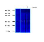 BRCA1 Antibody in Western Blot (WB)