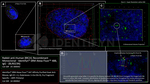 BRCA1 Antibody in Immunocytochemistry (ICC/IF)