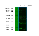 BRCA1 Antibody in Western Blot (WB)