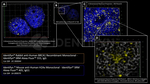 BRCA1 Antibody in Immunocytochemistry (ICC/IF)