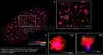 BRCA1 Antibody in Immunocytochemistry (ICC/IF)