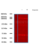 BRCA1 Antibody in Western Blot (WB)