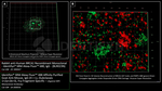 BRCA1 Antibody in Immunocytochemistry (ICC/IF)