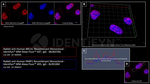 BRCA1 Antibody in Immunocytochemistry (ICC/IF)