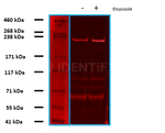 BRCA1 Antibody in Western Blot (WB)
