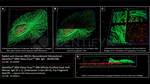 BRCA1 Antibody in Immunocytochemistry (ICC/IF)