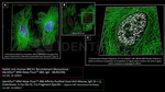 BRCA1 Antibody in Immunocytochemistry (ICC/IF)