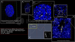 BRCA1 Antibody in Immunocytochemistry (ICC/IF)