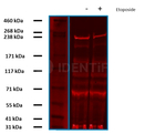 BRCA1 Antibody in Western Blot (WB)