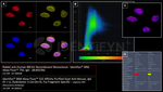BRCA1 Antibody in Immunocytochemistry (ICC/IF)
