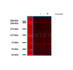 BRCA1 Antibody in Western Blot (WB)