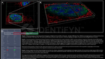 BAP1.p SRM Antibody in Immunocytochemistry (ICC/IF)
