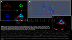 BAP1.p SRM Antibody in Immunocytochemistry (ICC/IF)