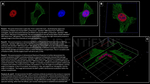 BAP1.p SRM Antibody in Immunocytochemistry (ICC/IF)
