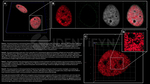 BAP1.p SRM Antibody in Immunocytochemistry (ICC/IF)