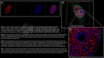 BAP1.p SRM Antibody in Immunocytochemistry (ICC/IF)