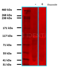 PARP1 Antibody in Western Blot (WB)