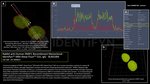 PARP1 Antibody in Immunocytochemistry (ICC/IF)