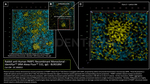 PARP1 Antibody in Immunocytochemistry (ICC/IF)