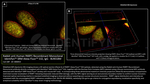 PARP1 Antibody in Immunocytochemistry (ICC/IF)