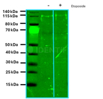 PARP1 Antibody in Western Blot (WB)