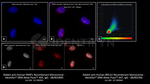 PARP1 Antibody in Immunocytochemistry (ICC/IF)