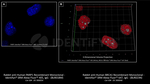 PARP1 Antibody in Immunocytochemistry (ICC/IF)