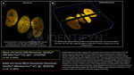 H2Ax Antibody in Immunocytochemistry (ICC/IF)