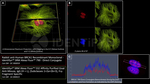 BRCA1 Antibody in Immunocytochemistry (ICC/IF)