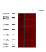 BRCA1 Antibody in Western Blot (WB)