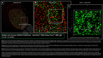 RAD50 Antibody in Immunocytochemistry (ICC/IF)
