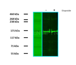 RAD50 Antibody in Western Blot (WB)