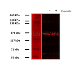 RAD50 Antibody in Western Blot (WB)