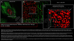 RAD50 Antibody in Immunocytochemistry (ICC/IF)