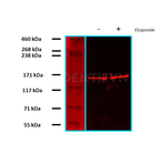 RAD50 Antibody in Western Blot (WB)