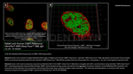 53BP1 Antibody in Immunocytochemistry (ICC/IF)