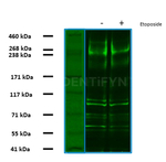 53BP1 Antibody in Western Blot (WB)