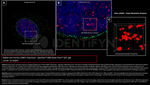 53BP1 Antibody in Immunocytochemistry (ICC/IF)