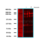 53BP1 Antibody in Western Blot (WB)