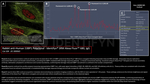 53BP1 Antibody in Immunocytochemistry (ICC/IF)