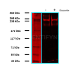 53BP1 Antibody in Western Blot (WB)