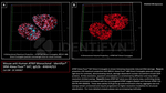 ATRIP Antibody in Immunocytochemistry (ICC/IF)