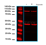 ATRIP Antibody in Western Blot (WB)