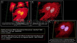 BRCA1 Antibody in Immunocytochemistry (ICC/IF)
