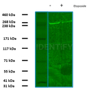 BRCA1 Antibody in Western Blot (WB)